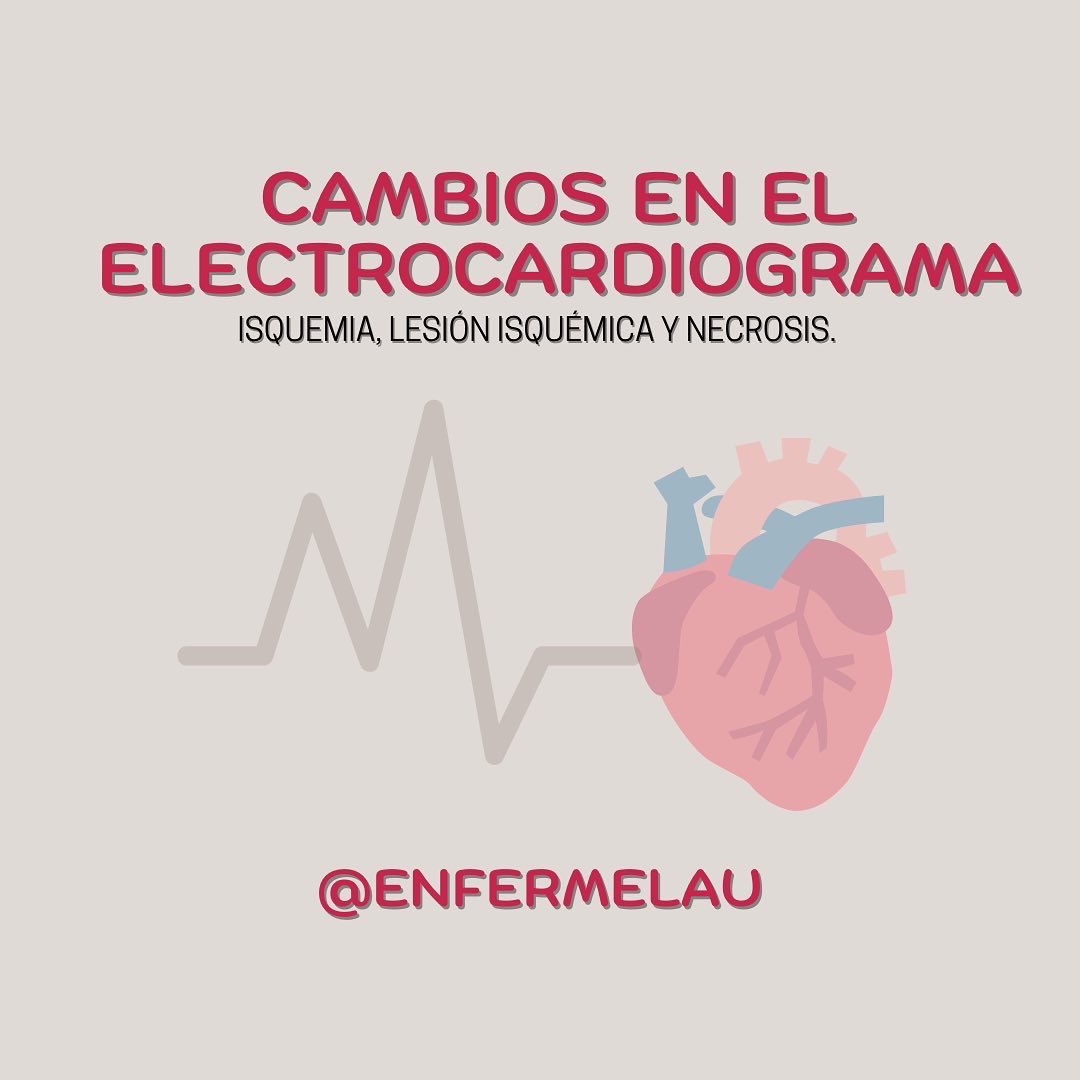 _Laauux's tweet photo. ¿Sabríais decirme qué diferencia hay entre isquemia, lesión isquémica y necrosis? He aquí un minihilo (post en Instagram @enfermelau) donde os explico a groso modo y resumido cuáles son las diferencias y que cambios podremos observar en el ECG.

Vamos a ello 🧵 https://t.co/vUJLp7xrij