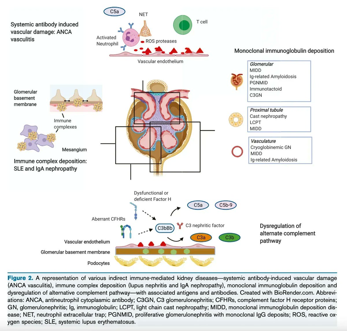 Advances in Understanding of Pathogenesis and Treatment of Immune-Mediated Kidney Disease: A Review

bit.ly/3Ea9elu (FREE)

<a href="/kantsmd/">Sam Kant</a> <a href="/AKronbichler/">Andreas Kronbichler</a> <a href="/purvasharma821/">purva sharma</a> <a href="/DuvuruG/">Duvuru Geetha</a> 

#pathogenesis #kidneydisease