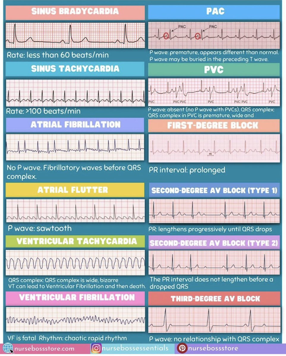Basics of ECG
