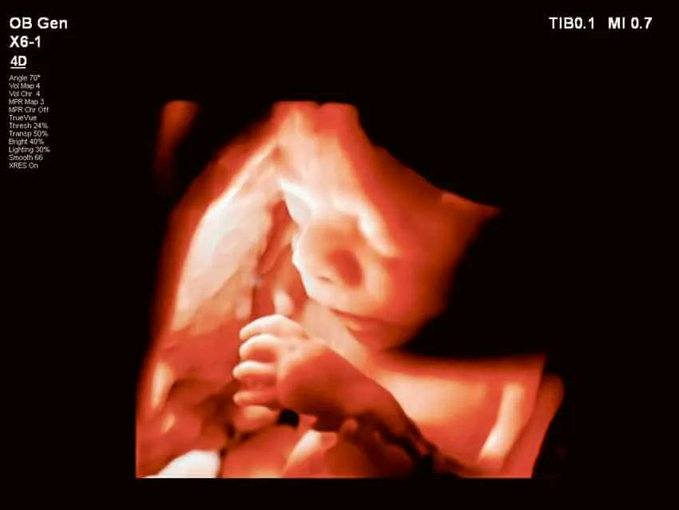 ESTADOS UNIDOS: Los abortos en Texas caen a 0, ahorrando hasta 5,700 bebés por mes lifenews.com/2023/01/04/tex… 
#StopAborto 
#DefiendeLaVida