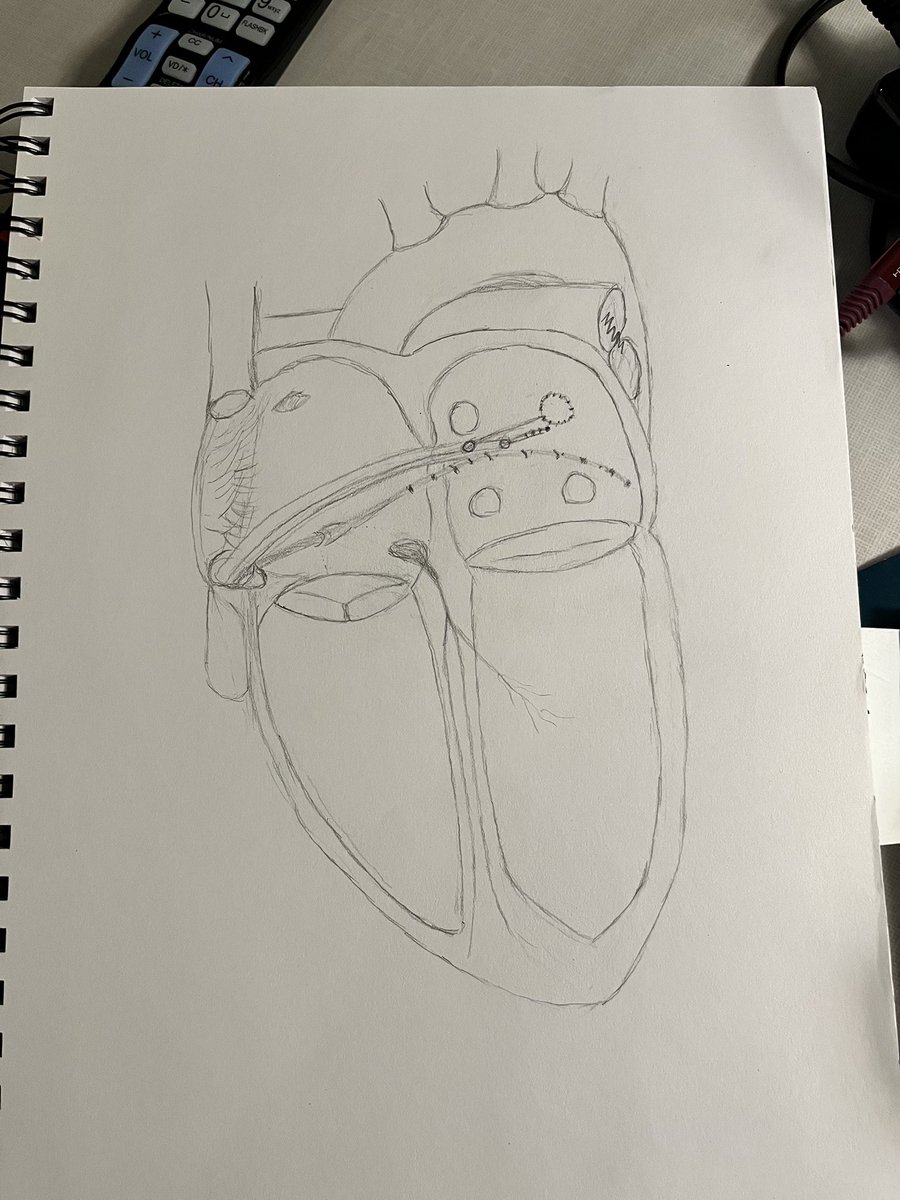 BIntervals's tweet image. From @ghstryder67 🫀🫀🫀
#CHARTpeeps #VivaEP 
@ChartAcademy