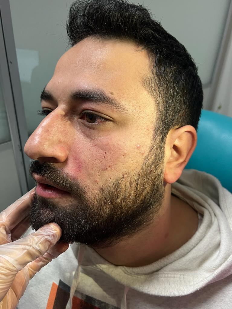 Elazığ il başkanımız poliklinik yaptığı sırada kendini bilmez bir hasta tarafından saldırıya uğramıştır. Saldırgana hak ettiği cezanın verilmesi için Hekimsen Hukuk Birimi gerekli adımları atacaktır. 

Bu kendini bilmezlere gereken ne zaman yapılacaktır?
<a href="/drfahrettinkoca/">Dr. Fahrettin Koca</a>
