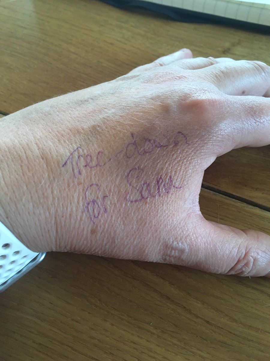 CrystalHenley's tweet photo. The synchronicity of it all @shaunwkeaveny !
@commgardenradio 
“Tree down for Sam,
Rhymes with dry Jan..”

(Yes I did write over a massive bruise with a purple pen…. didn’t think that through) X 💚 #whatsonyourhand #thisiscontent https://t.co/8bMtAJPgXR
