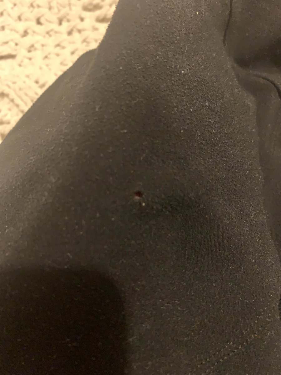 TynanDebi's tweet photo. @LornaJaneActive your poor quality tights @ high prices points, with terrible customer service. You've changed the quality of the material so faults occur and then you blame the consumer https://t.co/WV8owftbK5