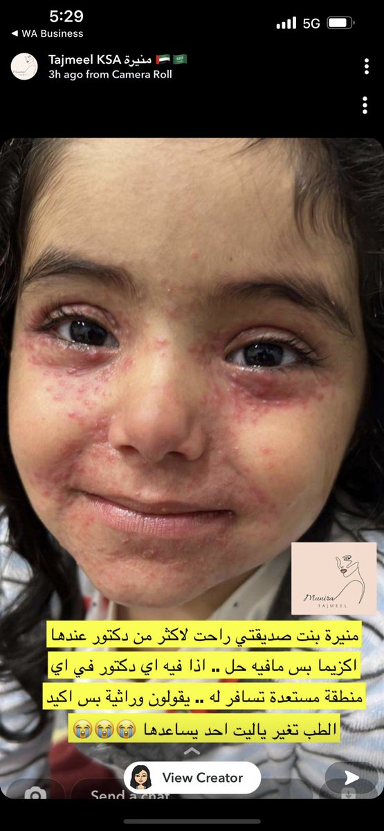 هذي البنت الله يحييها علاجها باذن الله عندي .. بسيطة ارسلوها لي