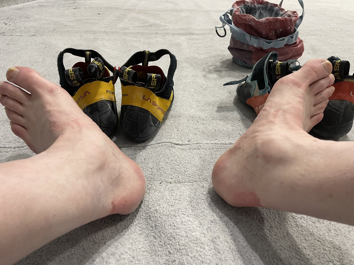 ExtremeSip's tweet photo. No pain no gain! Breaking in new La Sportiva Skwama @Sportiva  @mammut https://t.co/diMlEcqsGh