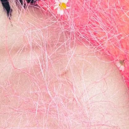 yoonkoous's tweet photo. the surgery scar 🥺 https://t.co/PiAVW1Bwkl