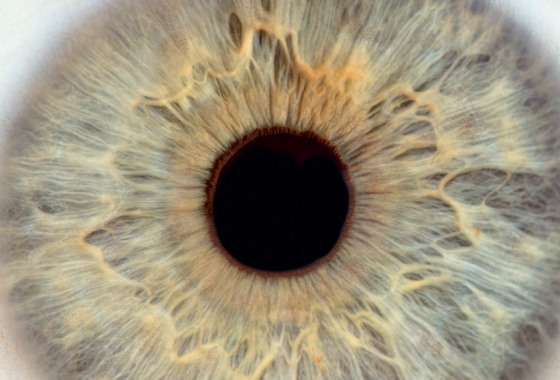 hug_ge's tweet photo. Lors de #strabisme, les yeux ne sont plus coordonnés pour regarder ensemble le même objet. Ce trouble de la vue se caractérise par la déviation d’un œil par rapport à l’autre: un œil fixe l’objet à regarder et l’autre regarde ailleurs #ophtalmologie #oeil https://t.co/zeSIL7xt9S https://t.co/C8exIlh0AP