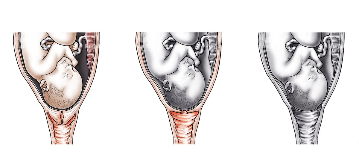 Humantouchart's tweet photo. Been having a little new year website revamp! Happy 2023!!!

https://t.co/bYyg1SIMQG

#cervix #pregnancy #midwife #medicalart #medicalillustration #sciart #midwifery #labour https://t.co/gwjsL4gk9o