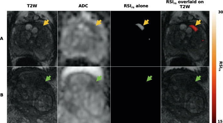European Urology Open Science tweet media