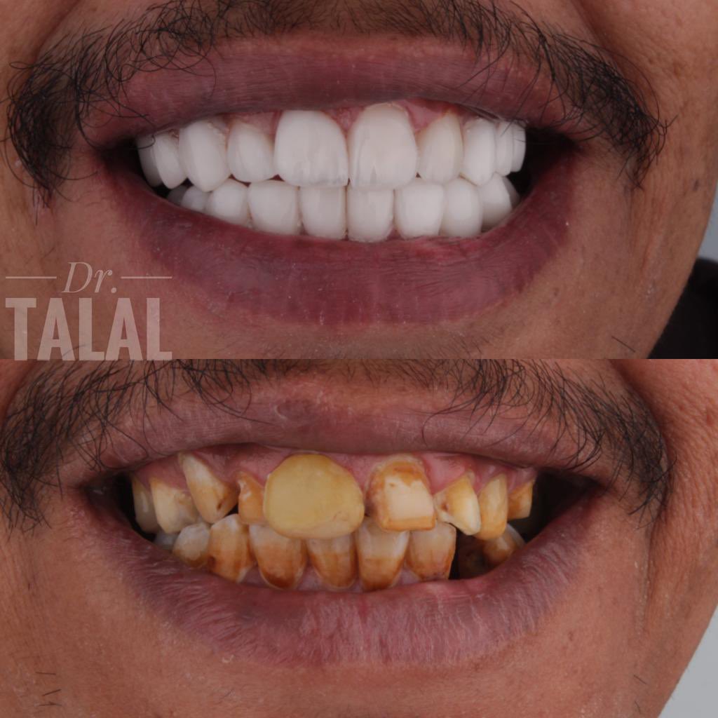 beaupalace1's tweet photo. #عيادات_اسنان  #الخميس_الونيس لا تأجل علاج أسنانك وتجميلهم مع عروضنا المميزة للأسنان في بداية العام احجز للحصول على إبتسامتك الفريدة 😁 للحجز و الاستفسار📞 0552557304 https://t.co/LVwq8mjNVr