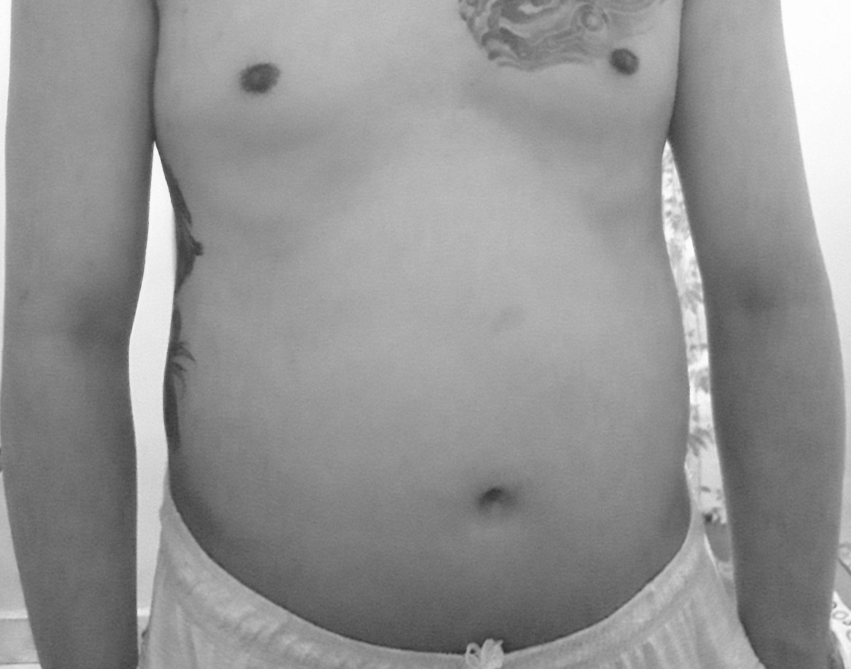 _Hrst's tweet photo. Percayalah, ikutin semua kata dia. 2 bulan doang ini. 
++nya w cuma push up doang, mau tidur 8x, bangun tidur 8x (kuatnya segini doang kadang lebih dikit tapi tiap hari) https://t.co/8nRlBgQ7dP