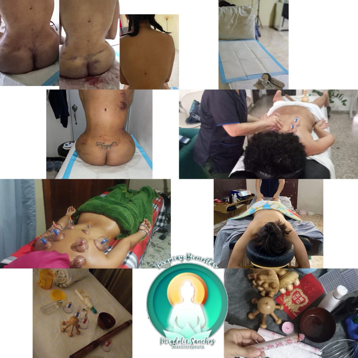 migdeyhes's tweet photo. continuamos llevando para ti #armoniasaludybienestarintegral 
#terapiasalternativas #masajedescontracturante #masajeterapeutico #piedrascalientes #ventosas #drenajelinfaticopostoperatorio #acupuntura #moxibustion #aromaterapia #cristaloterapia #tuina #descargadeportiva https://t.co/50nvBvyWyU