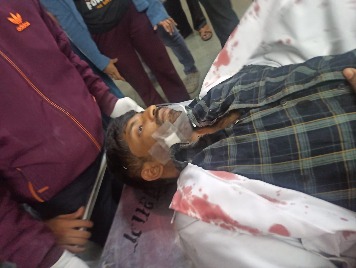 deekaaayyyy's tweet photo. Evening rounds on 5th January 7.30pm, a patient out of nowhere assaults and stabs a 1st year surgery resident with a knife on the neck behind his back.
Two surgery resident are injured, out of which one is severly injured and is undergoing operation.
📍 SVNGMC,YAVATMAL  (1/2) https://t.co/0mej6eUBb7
