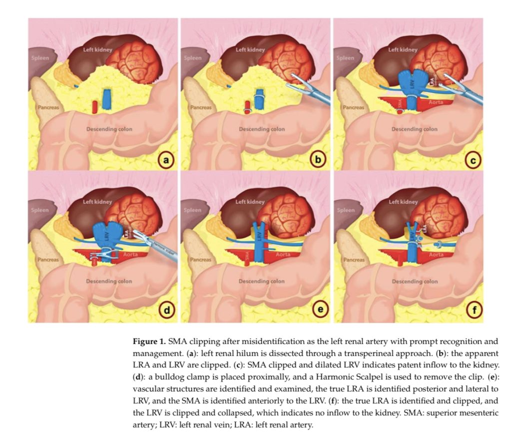 Dr. Giovanni E Cacciamani MD MSc FEBU 🇮🇹🇺🇸🇪🇺 tweet media