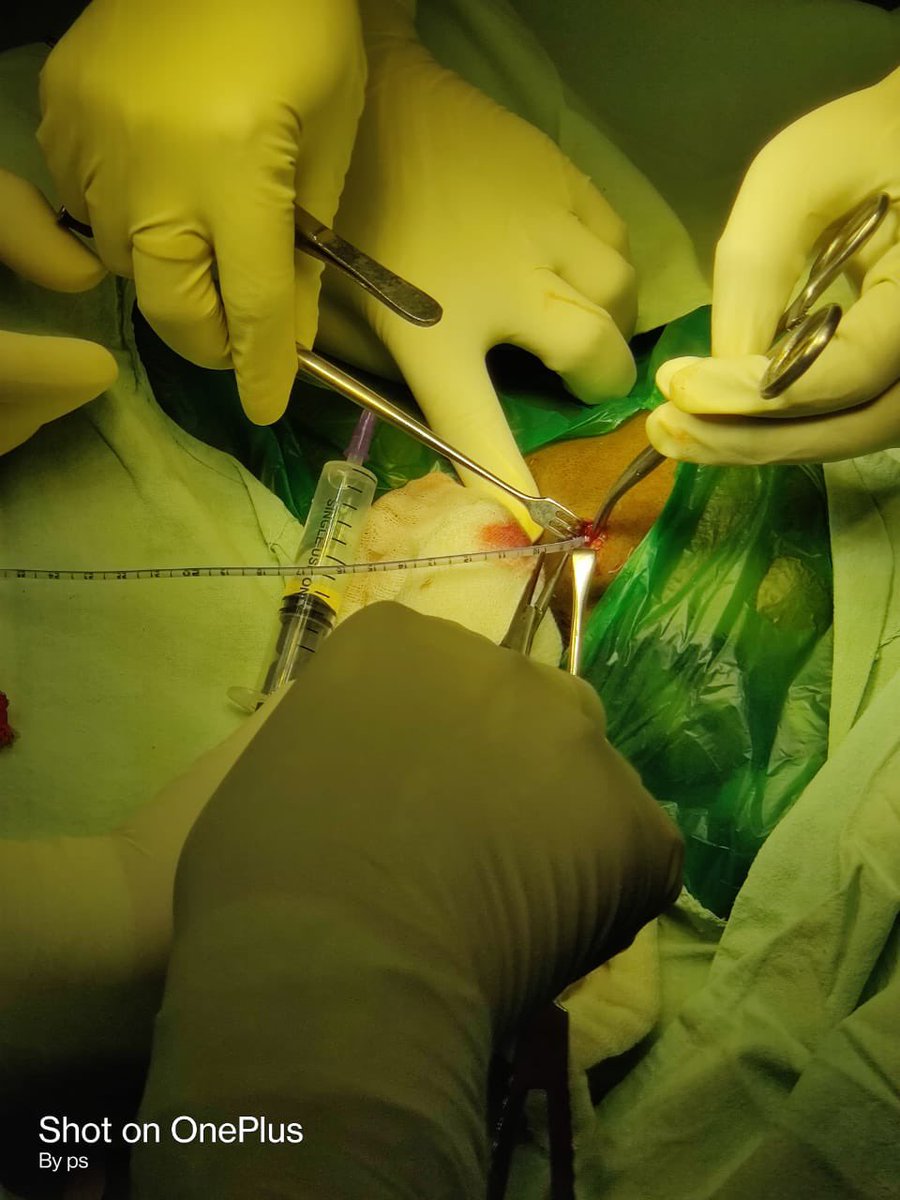Indian__doctor's tweet photo. #Brutal Attack‼️
Surgery resident at GMC #Yavatmal stabbed on duty in the neck. 
Two residents injured, one is VERY critical.
Kindly PRAY for him🙏🏻
This is Why Doctors were demanding central protection act
@PMOIndia @CMOMaharashtra
@mansukhmandviya @ANI @PIBMumbai 
#MedTwitter https://t.co/YdSHPP8Ufu