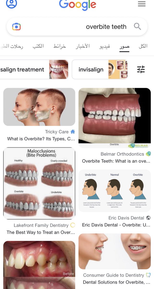 llvBeel's tweet image. My life in 4 pic ..

#DentalAssistant #Batch6 #Block1