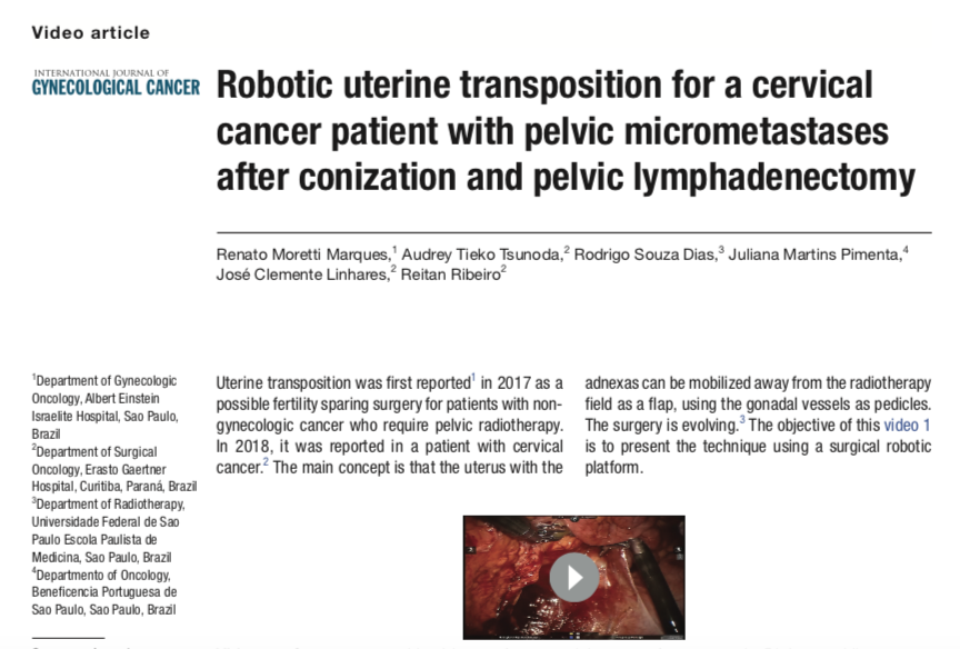 IJGConline's tweet photo. Robotic uterine transposition for a #cervicalcancer patient w/ pelvic micrometastases after conization and pelvic lymphadenectomy, a #videoarticle of a 28-yo patient w/ squamous cell carcinoma of the cervix, ST IA1, w/ LVSI #uterinetransposition
https://t.co/VNwBHSwWtC https://t.co/OQv4J7NLA7