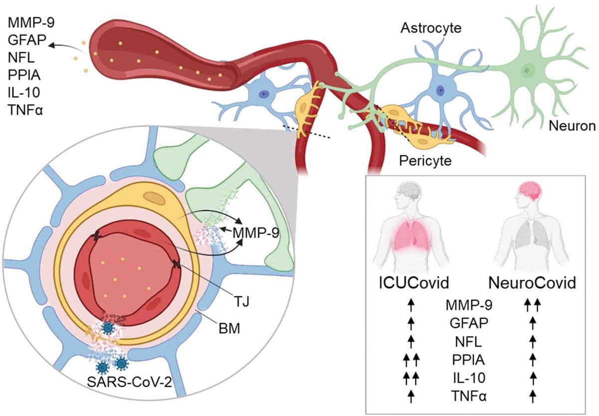 Markers of blood-brain barrier disruption increase early and persistently in COVID-19 patients with neurological manifestations | #bloodbrainbarrier #covid19
pubmed.ncbi.nlm.nih.gov/36591311/