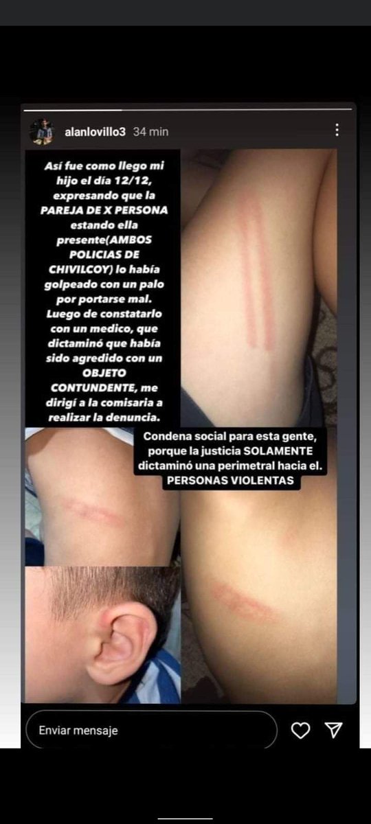 Ojala esto no quede en la nada!
Estas dos mierdas se merecen lo peor, pero ella como madre se merece mucho más por dejar q su pareja maltrate a su propio hijito