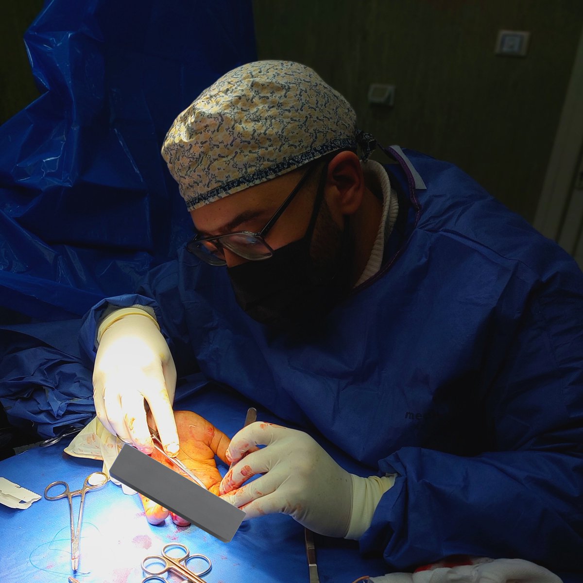 Ibrahim_Rajaee's tweet photo. Hand surgery ❤️🖐️
#plasticsurgeon #plasticsurgery #surgeon #hand_surgery https://t.co/P8UyxLe1Sz