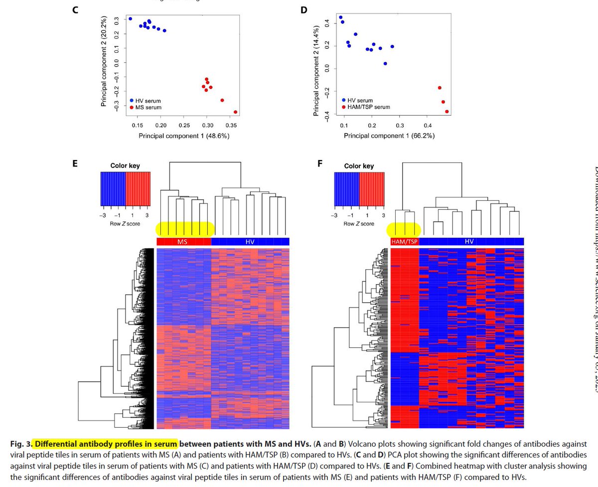 westr's tweet photo. The repertoire of #CSF #antiviral antibodies in patients with neuroinflammatory diseases https://t.co/v6YSo9Goxg @ScienceAdvances #MultipleSclerosis
#CNS #EBV #neuroinflammation #BCells #VirScan

Waiting for the jury to return on the causative basis of #MS .. https://t.co/8FH6m8hKFU