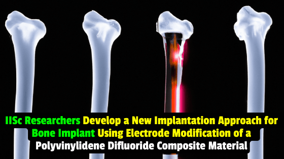 IISc Researchers Develop a New Approach Using Electrode Modification for Bone Implants