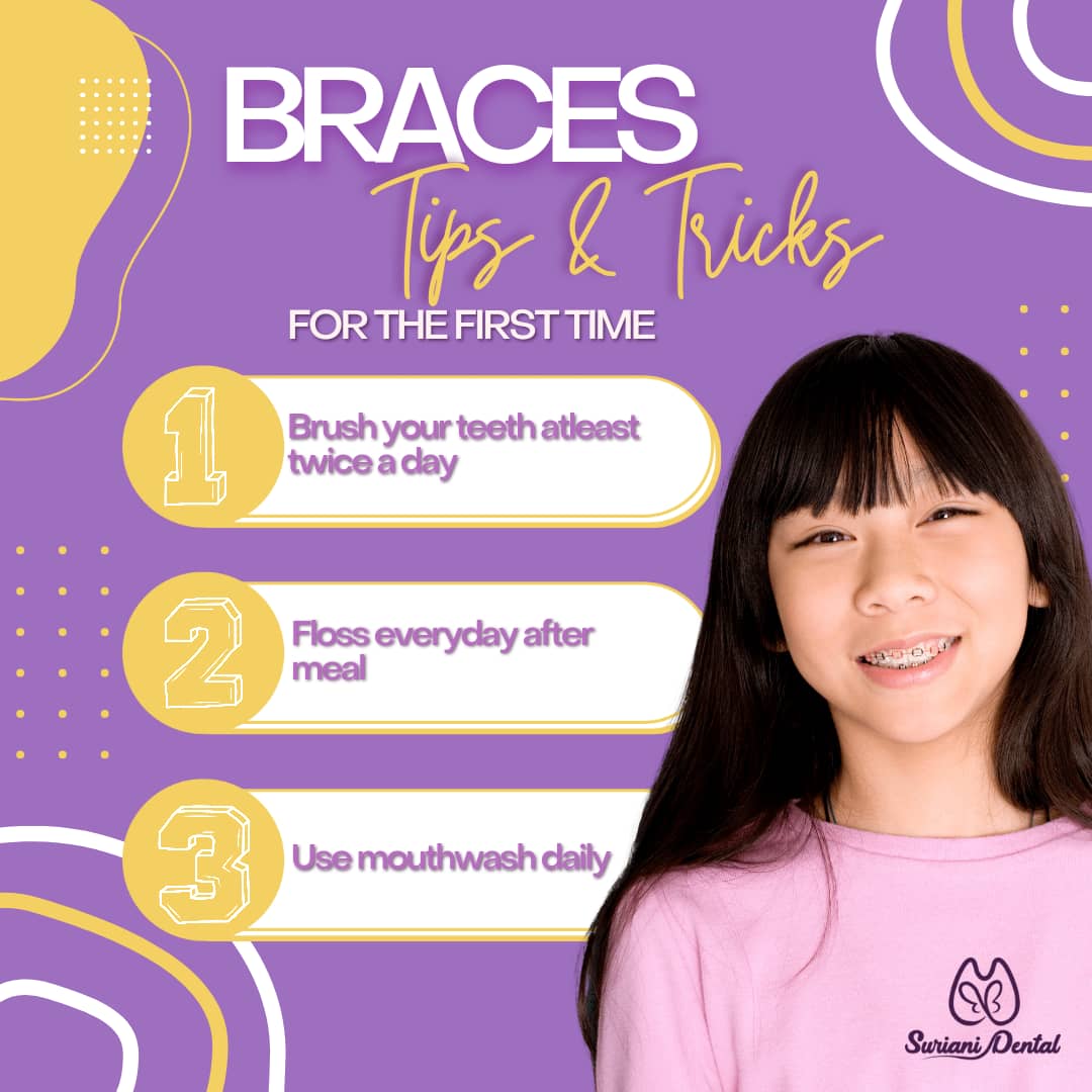 😍DONT FORGET TO COME AND VISIT FOR YOUR BRACES MONTHLY REVIEW😍

✨Enjoy your braces journey with us at SURIANI DENTAL🦷

OPEN EVERYDAY ✅

#love #surianidental #bracespromotion #lowdeposit #offer  #treats #klinikpergigiansuriani #bestservice #qualityservice #oralhealthprovider