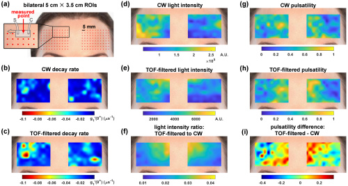 vjsriniv's tweet photo. Just out in Optica...human #brain #opticalimaging with a highly parallel, time-of-flight informed approach! Interferometric #NIRS charges ahead! https://t.co/XslfF8dj7e
@NYUGrossman @ucdavisNCIBT @OpticaWorldwide https://t.co/frFWTCYR5W