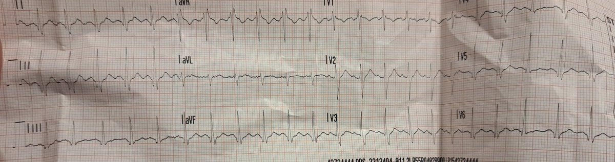 Electrophysiology tweet media