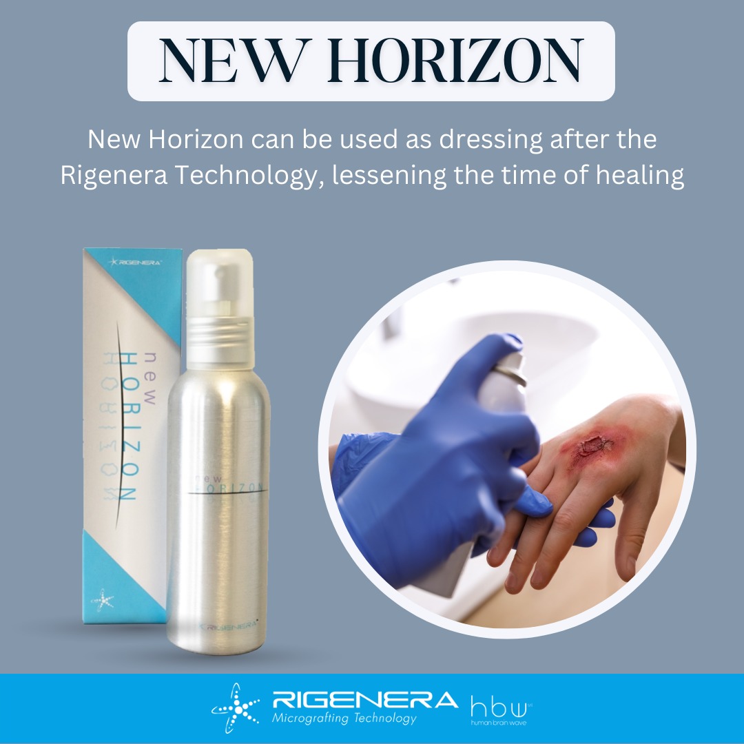 RigeneraHBW's tweet photo. New Horizon can be used as dressing after the Rigenera Technology, lessening the time of healing surgical wounds,
https://t.co/9blDyP0l50
#rigenera #regenerativemedicine #medicine #woundhealing #woundcare #rigeneratechnology #rigenera #hbw #newhorizon #chronicwound #burns https://t.co/0GngO2LU4w