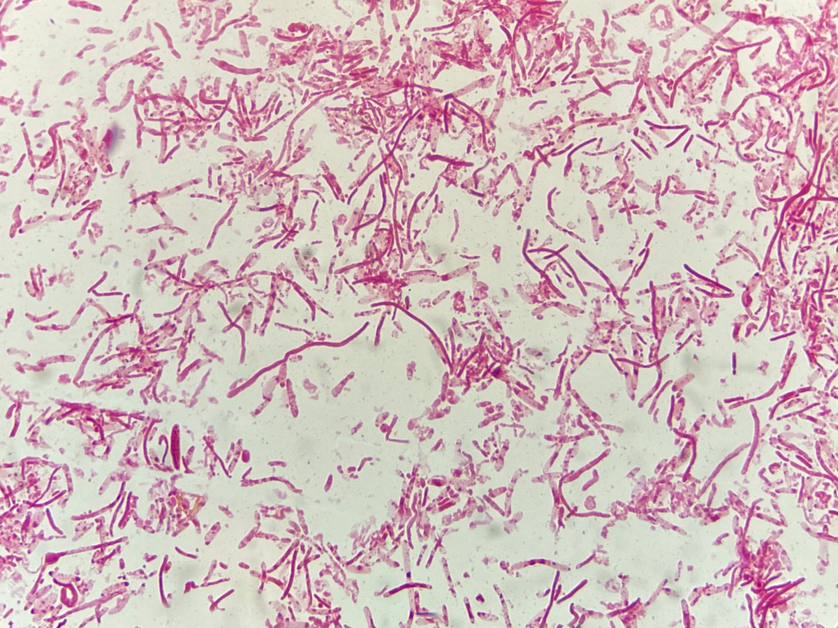 yihan_kaiserin @NatureComms @GrandjeanTeddy @CIILofficiel Muribaculum  intestinale is a Gram-negative anaerobe that tolerates only short exposure  to oxygen and takes seven days to cultivate.