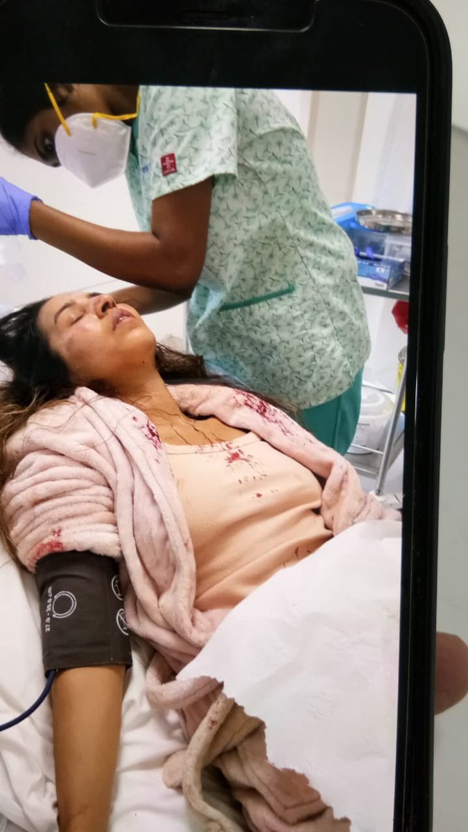 Hi <a href="/CPBlr/">CP Bengaluru ಪೊಲೀಸ್ ಆಯುಕ್ತ ಬೆಂಗಳೂರು</a> I was attacked by goons brutally yesterday. I always helped and supported <a href="/BlrCityPolice/">ಬೆಂಗಳೂರು ನಗರ ಪೊಲೀಸ್‌ BengaluruCityPolice</a> whenever needed. Now, when I'm in pool of blood, nobody is there for help.