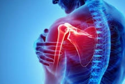 MikeEckstein_'s tweet photo. These 5 exercises have ELIMINATED all my shoulder pain. (And I did some damage to it playing college baseball)

They will help you too!

=thread= https://t.co/OKPVLVz2Mn