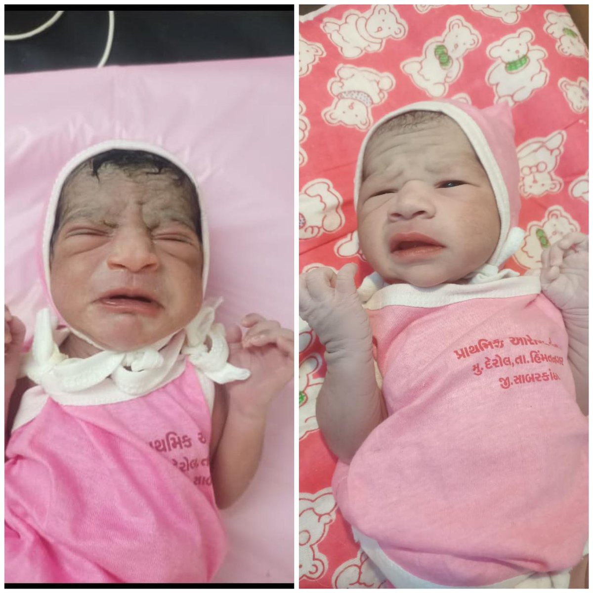 CdhoSabarkantha's tweet photo. Today 2 FTND at derol #phc. #JSSK benefits & #Sanitary napkins given.
#IBNC done #KMC,#Latching & #iycf chart explained.
by SN. # inj vit K, Hep B 0 dose, B-opv dose given to baby. #PPIUCD inserted @GujHFWDept @NHMGujarat @CollectorSK @dalal_rupal @sabarkanthadp https://t.co/bhfQhdSHVx