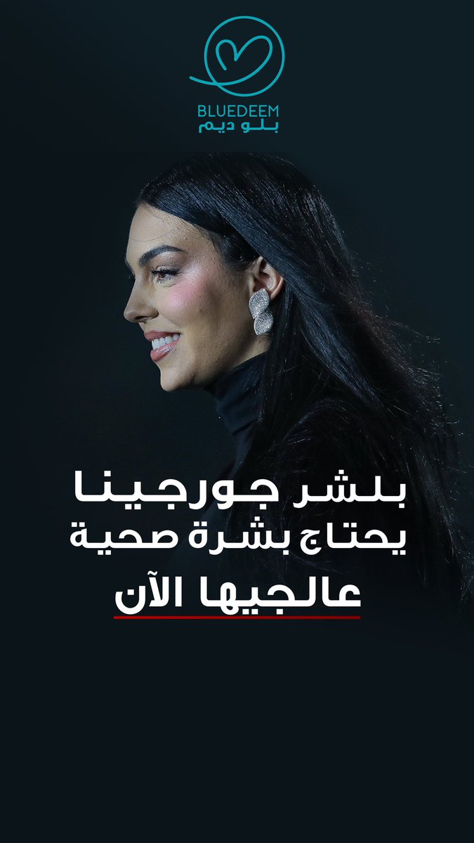 fhasif2's tweet photo. #جورجينا https://t.co/BkotTjMquT