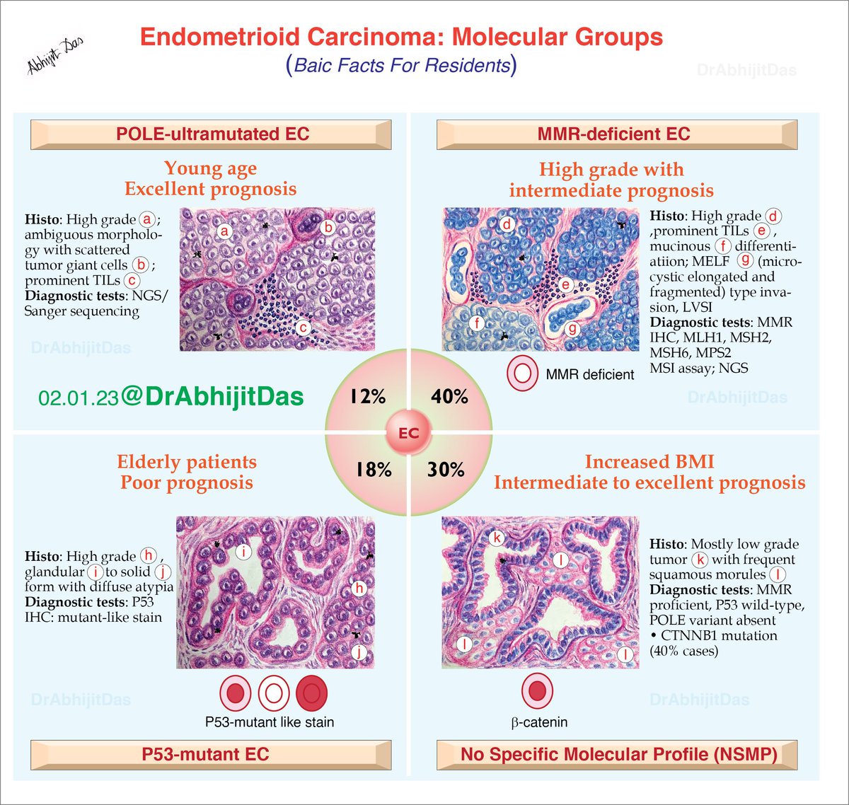Endometrioid carcinoma: molecular groups Basic facts for residents #MakeSurgiPathEasy