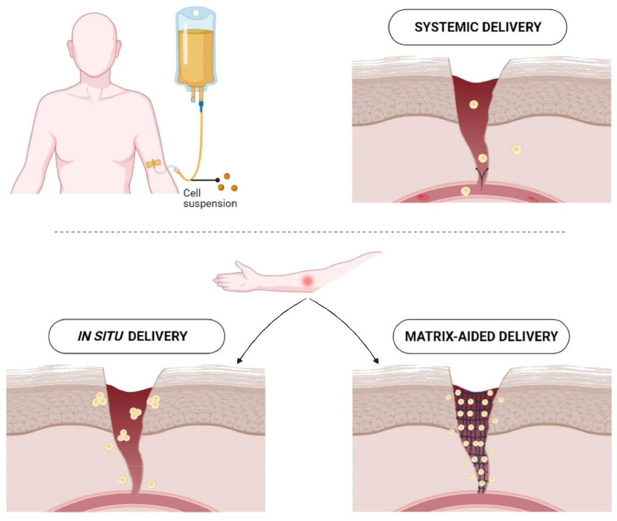 #MDPIPharmaceutics 
"Convergence of Biofabrication Technologies and Cell Therapies for Wound Healing" by Motaharesadat Hosseini et al.

Full paper at： mdpi.com/1999-4923/14/1…