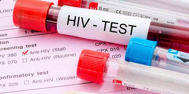 ImpactersYouth's tweet photo. The recent reports showing a surging #HIV infections in #Nakuru especially among young girls and women aged between 10-35 are worrying. We call upon the government and stakeholders to join efforts fighting this disease that is robbing the youth of their future. 
#UNAIDS 
#LVCT https://t.co/X3UrSQbafQ