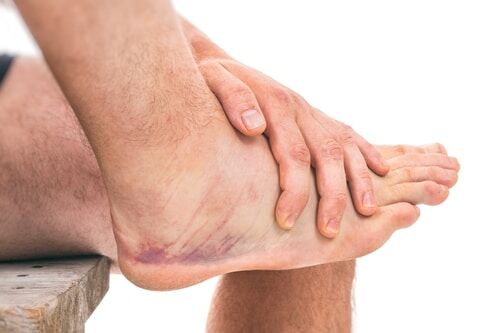 dynamichealthje's tweet photo. Did you know... If unmanaged, #AnkleSprains can produce longer lasting problems such as β strength, β balance & β flexibility & β risk of future injuries.
#FootPain #FootFunction #InjuryPrevention #DynamicHealth #Chiropractic #Physio #Osteopathy #JerseyCI https://t.co/ASsg99o6WK