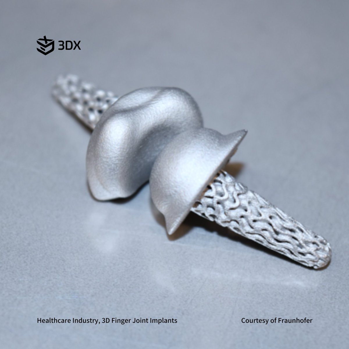 3DX_AM's tweet photo. 💡The team behind the "FingerKit" project has developed an automated implant design process that uses AI to transform 2D X-ray images into 3D finger models. 💯
#hp3d #3dhp #3d #3DPRINT #3dhp580 #3dcolor #color3d #3dsample #hp3dprinting #hpmjf4200 #design3D #mjf3dprint https://t.co/e0ij2ZJGF9