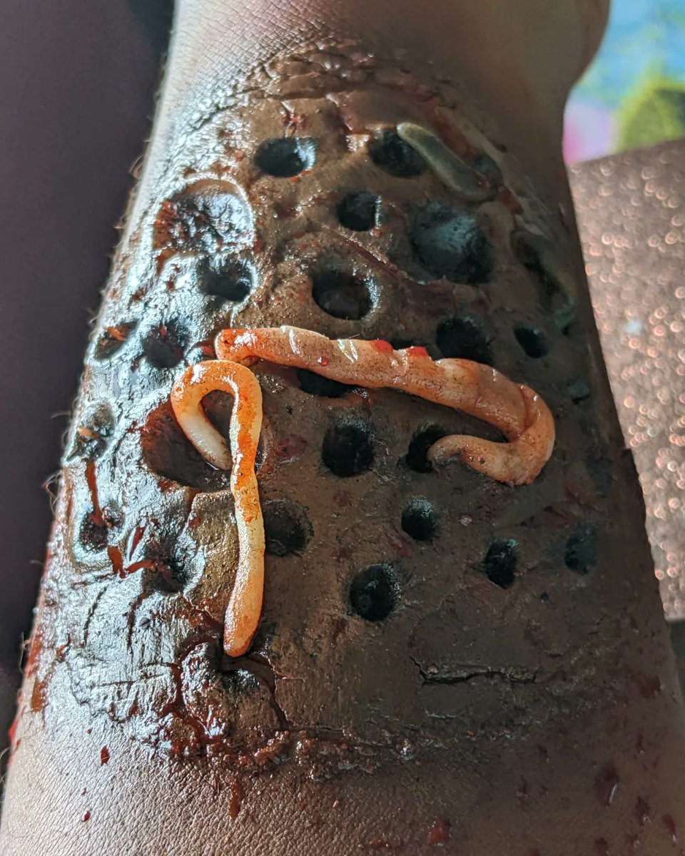 doxalenny's tweet photo. New year
New wounds
#fakewound #fakeblood #trypophobia https://t.co/TEaO08mzFq