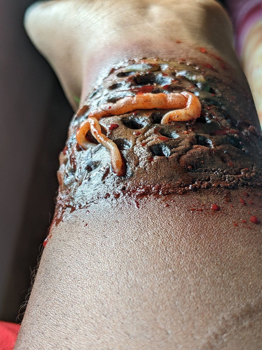 doxalenny's tweet photo. New year
New wounds
#fakewound #fakeblood #trypophobia https://t.co/TEaO08mzFq