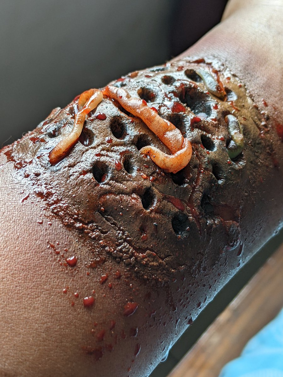 doxalenny's tweet photo. New year
New wounds
#fakewound #fakeblood #trypophobia https://t.co/TEaO08mzFq