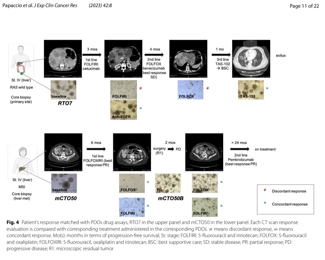 TarazonaNoelia's tweet photo. 👉 Just out our paper 📄on the role of organoids 🧫 as a tool to guide precision medicine in advanced colorectal cancer patients
@GVAclinic @incliva_iis 

📌 Are organoids the future of medical research❓

✔️Don’t miss reading it👇
https://t.co/zL8wwdrrFP https://t.co/CZqjPDZdGb