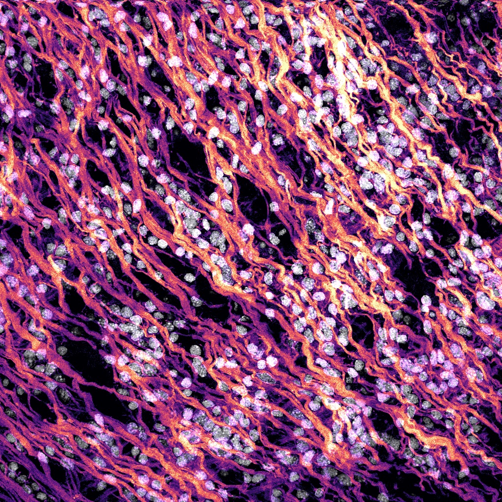 Some Hofstenia muscle for the first #FluorescenceFriday of the year!
