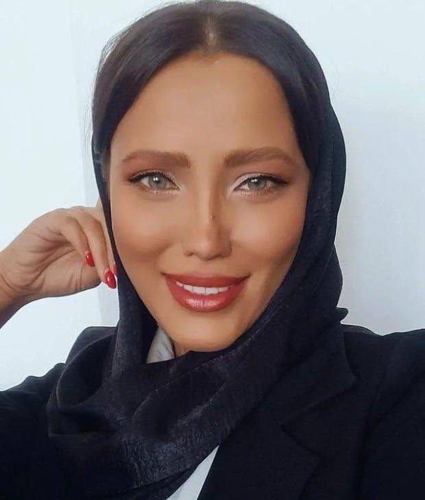 omid9's tweet photo. Raheleh Amiri, a psychologist who lost an eye in #IranRevolution protests after being shot by #IRGCterrorists put a story on her insta: 

‘They asked me was it was worth it?’

I said firmly “yes, very much.” 

You can’t burn women made of fire 🔥 https://t.co/5pDTSoL2EK