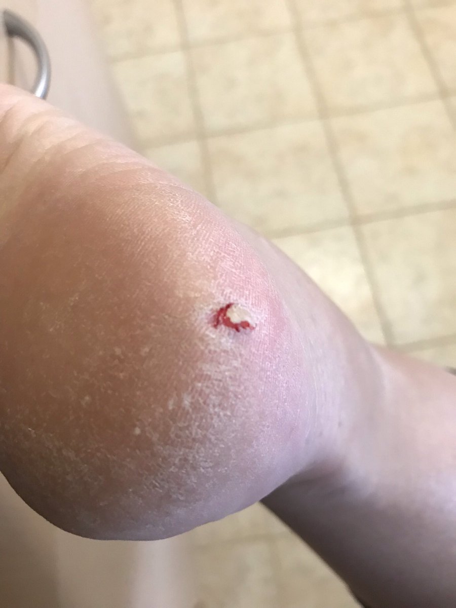 People laugh when parents talk about #Lego injuries but let me assure you, they’re no laughing matter 😭
(Please excuse how dry my feet are. I’m both a parent and not a rich celebrity. Feel free to send money for pedicures - No other feet pics will be provided)
