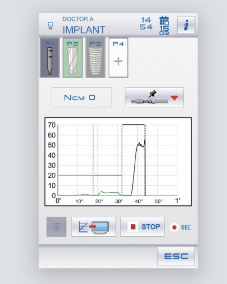 STERN WEBER S380TRC - PERFECT IMPLANTOLOGY INTEGRATION. 
Selecting implant mode turns the Full Touch control panel into a dedicated interface for surgical operations. Implantologists are provided with everything needed to perform treatment, significantly speeding up workflows.