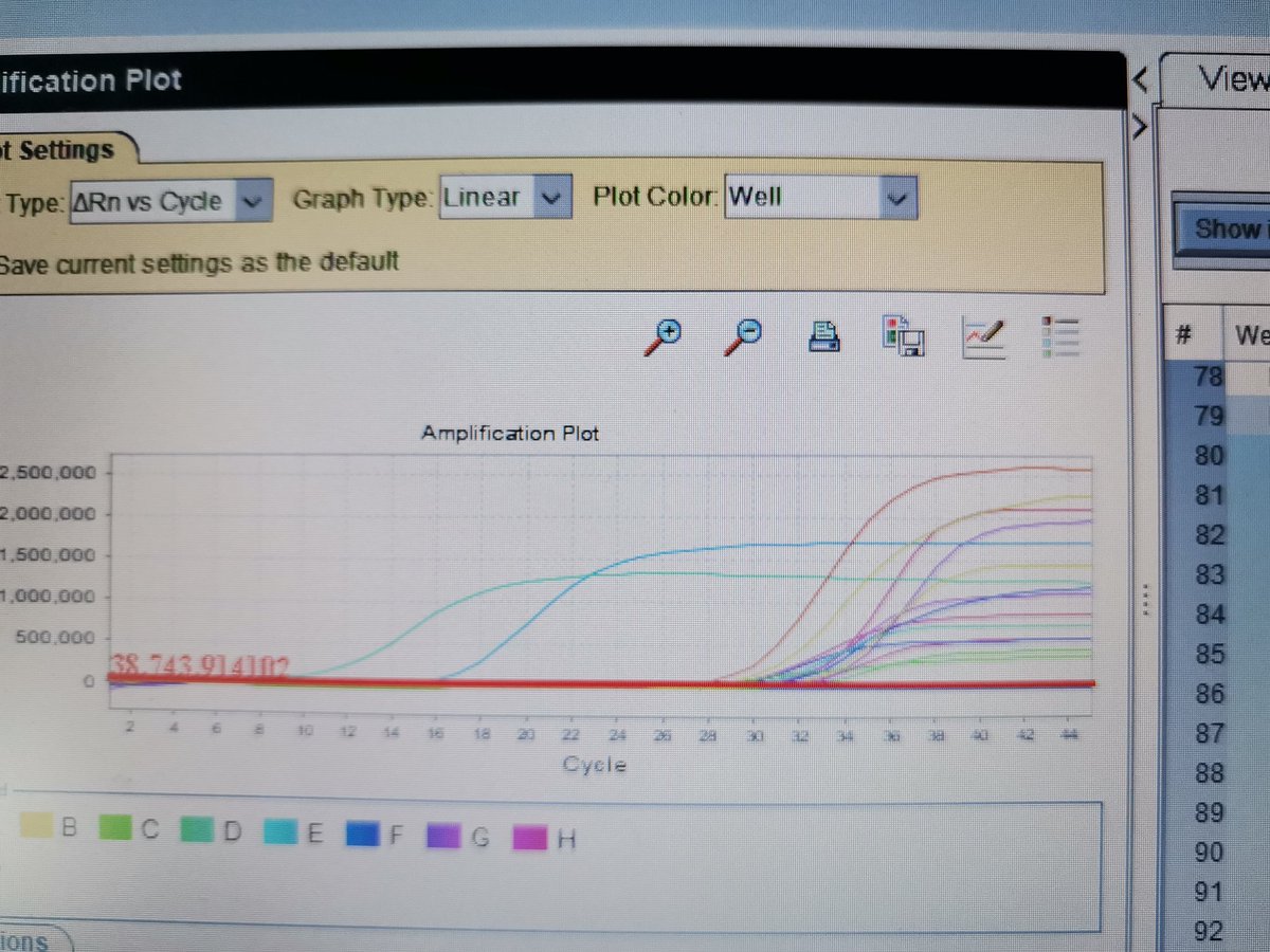 pchigwe's tweet photo. Our initial Vibrio cholerae and Salmonella Typhi real-time results. #Wastewaterbasedpathogen detection. https://t.co/4ccQRfmM8W